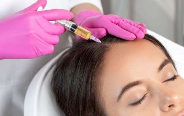 PRP Hair Therapy for Women: Safe, Effective, and Non-Surgical