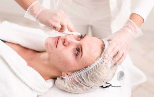 How Pimples Treatment Supports Healthy Skin Care