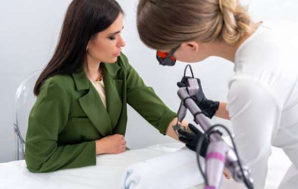 Laser Tattoo Removal for Enhancing Personal Appearance