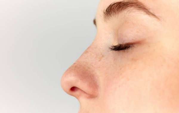 إحصائيات نجاح عملية تجميل الأنف في الرياض