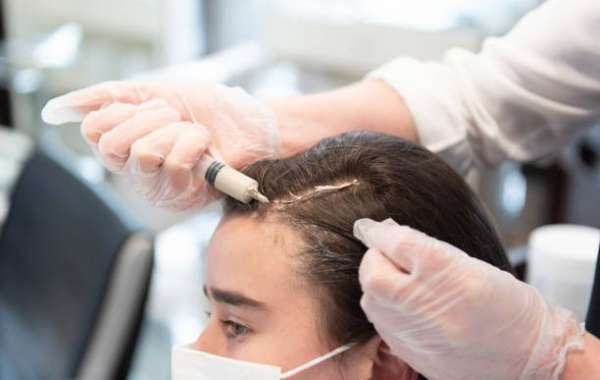 Revive Dormant Hair Follicles with PRP: Your Path to Natural Density