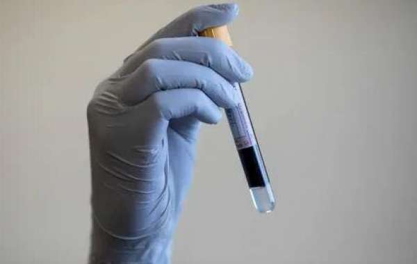 Ureaplasma Test After Treatment: When to Retest