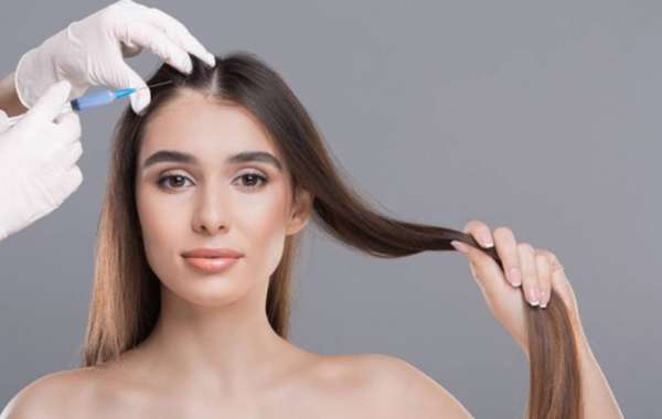 PRP Hair Treatment for Alopecia: Can It Help?