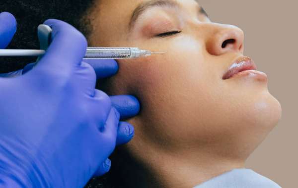 Profhilo Treatment Injection Techniques Explained