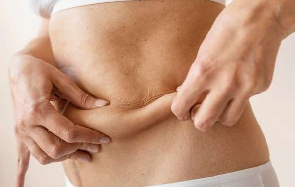 Are Fat Melting Injections a solution for stubborn tummy bulges?