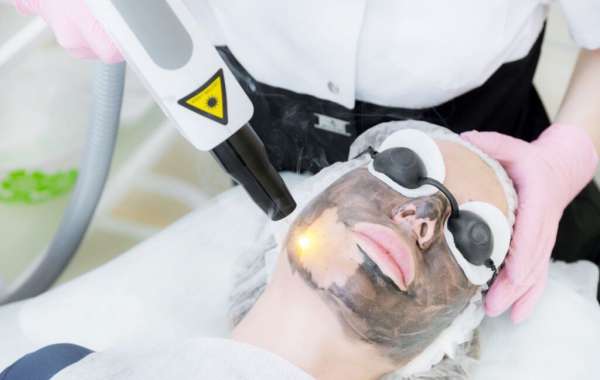 Laser Carbon Peel Glow Skin Shine for Fresh Even Texture