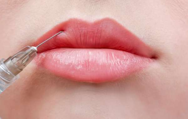 Benefits of Choosing Russian Lip Filler for Lip Enhancement