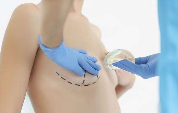 Most Recommended Clinics for Breast Surgery Clinic