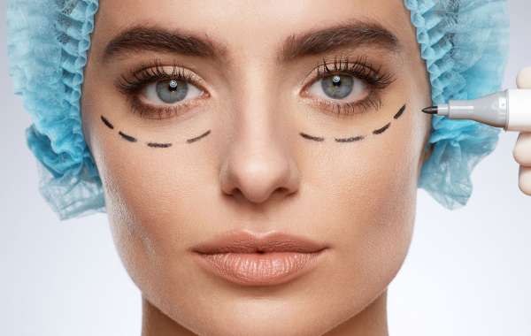 Eye Bag Removal for Women of Every Age and Skin Type