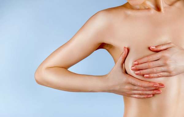 Breast Reduction Surgery: Key Benefits, Results, and Recovery