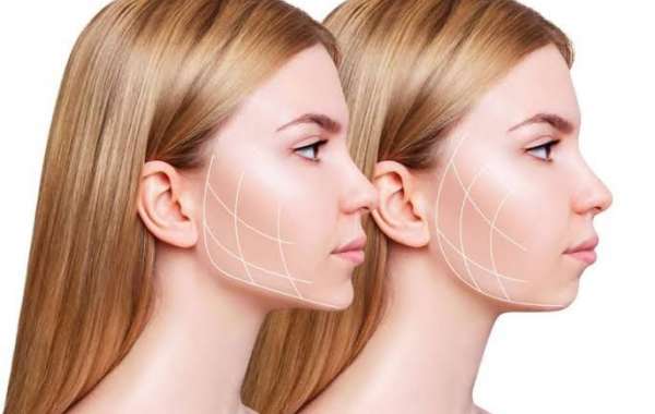 What Makes the Best Clinic for Bichectomy Surgery in Dubai?