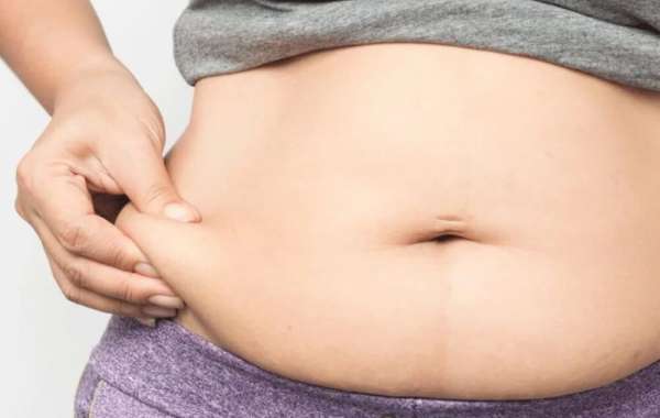 Fat Transfer Surgery Restores Volume with a Soft, Natural Aesthetic Glow
