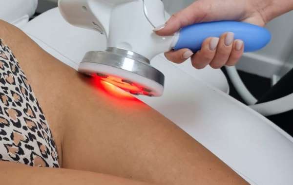 What Is Eximia Treatment and How Can It Improve Body Contouring?
